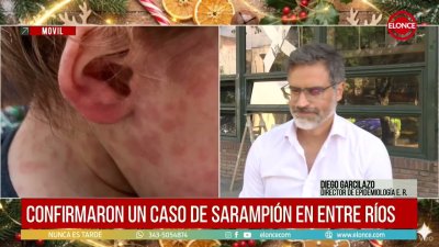 Confirmaron un caso de sarampi&oacute;n en Entre R&iacute;os e investigan el origen del contagio